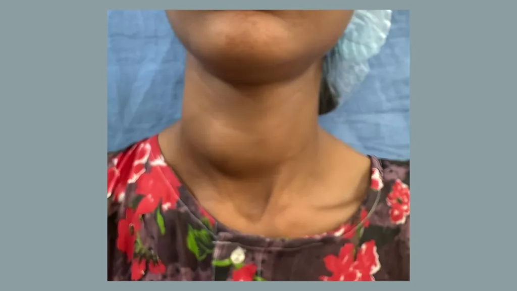 एसएमएस अस्पताल में हुआ राजस्थान का पहला रेट्रोऑरिक्यूलर एंडोस्कोपिक थाइरोइड ऑपरेशन सफल 2 Copy of rajasthan emergency helpline numbers 2025 8